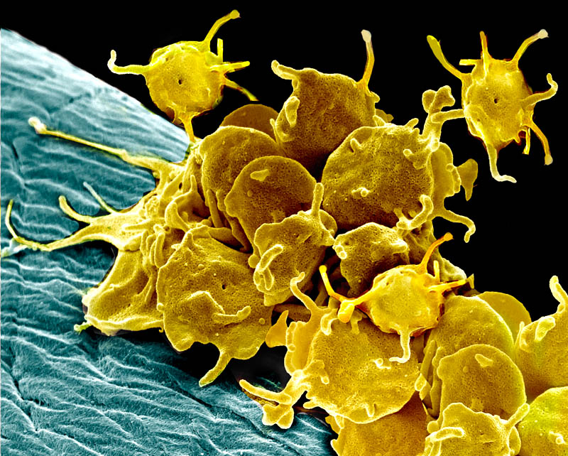 Activated platelets are the key compontent of PRP Prolotherapy, scanning electron micrograph. Magnification 2000x