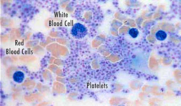 A microscopic slide of Platelet-Rich Plasma (PRP)