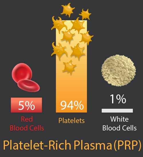 Percentage of cells types in Platelet-Rich Plasma (PRP)