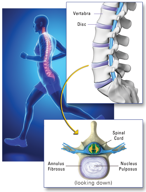 A montage of a person running and a human spine illustraing basic spinal anatomy.