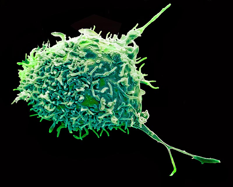 A human mesenchymal stem cell (MSC). Magnification 3000x